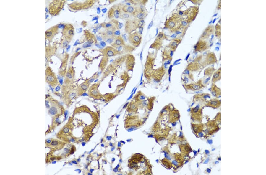 Anti-HYAL1 Antibody from Bioworld Technology (BS8303) - Antibodies.com