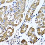Anti-HYAL1 Antibody from Bioworld Technology (BS8303) - Antibodies.com