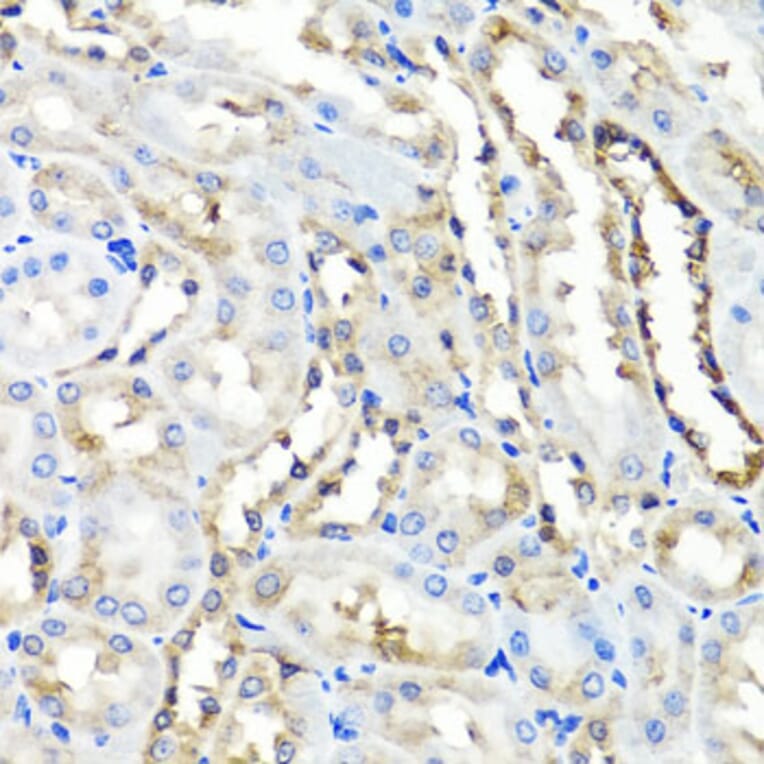Anti-HYAL1 Antibody from Bioworld Technology (BS8303) - Antibodies.com