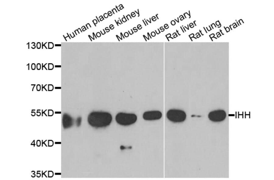 Anti-IHH Antibody from Bioworld Technology (BS8306) - Antibodies.com