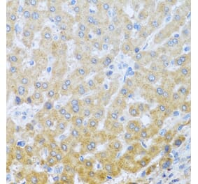 Anti-IL20 Antibody from Bioworld Technology (BS8309) - Antibodies.com
