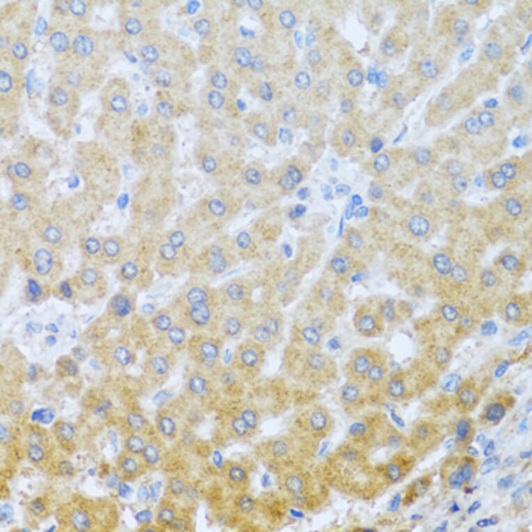 Anti-IL20 Antibody from Bioworld Technology (BS8309) - Antibodies.com