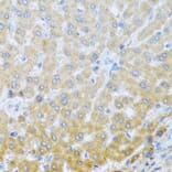 Anti-IL20 Antibody from Bioworld Technology (BS8309) - Antibodies.com