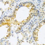 Anti-IL20 Antibody from Bioworld Technology (BS8309) - Antibodies.com