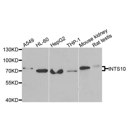 Anti-INTS10 Antibody from Bioworld Technology (BS8312) - Antibodies.com
