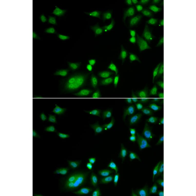 Anti-INTS10 Antibody from Bioworld Technology (BS8312) - Antibodies.com