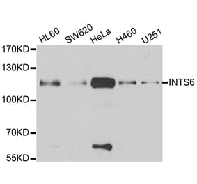 Anti-INTS6 Antibody from Bioworld Technology (BS8314) - Antibodies.com