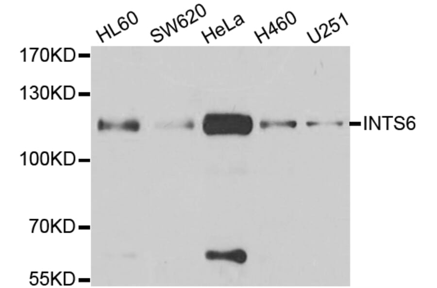 Anti-INTS6 Antibody from Bioworld Technology (BS8314) - Antibodies.com