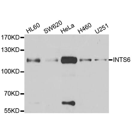 Anti-INTS6 Antibody from Bioworld Technology (BS8314) - Antibodies.com