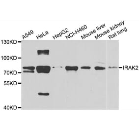 Anti-IRAK2 Antibody from Bioworld Technology (BS8315) - Antibodies.com