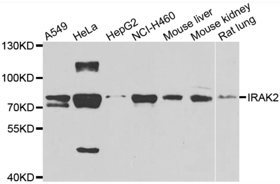 Anti-IRAK2 Antibody from Bioworld Technology (BS8315) - Antibodies.com