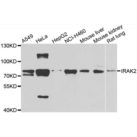 Anti-IRAK2 Antibody from Bioworld Technology (BS8315) - Antibodies.com