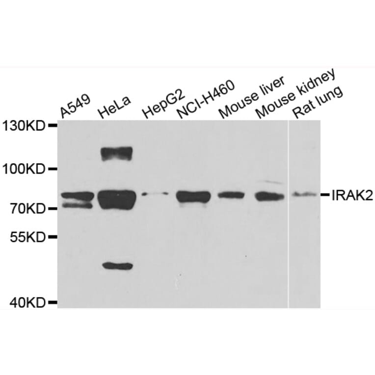 Anti-IRAK2 Antibody from Bioworld Technology (BS8315) - Antibodies.com