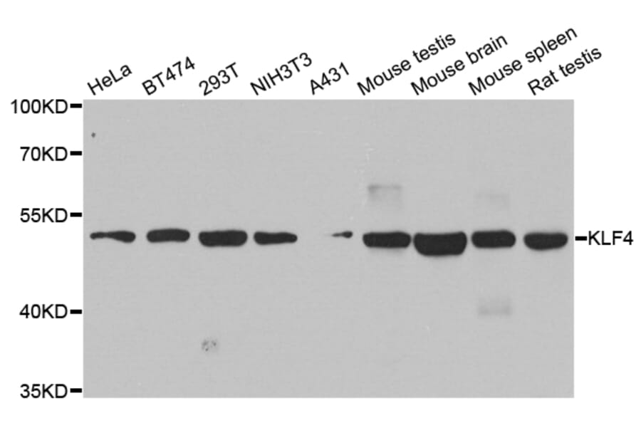 Anti-KLF4 Antibody from Bioworld Technology (BS8318) - Antibodies.com