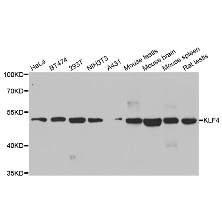 Anti-KLF4 Antibody from Bioworld Technology (BS8318) - Antibodies.com