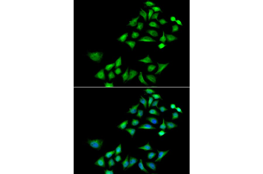 Anti-KLK4 Antibody from Bioworld Technology (BS8319) - Antibodies.com