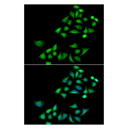 Anti-KLK4 Antibody from Bioworld Technology (BS8319) - Antibodies.com