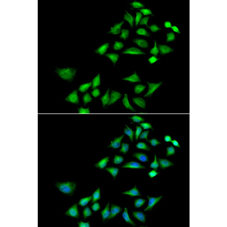 Anti-KLK4 Antibody from Bioworld Technology (BS8319) - Antibodies.com