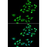 Anti-KLK4 Antibody from Bioworld Technology (BS8319) - Antibodies.com