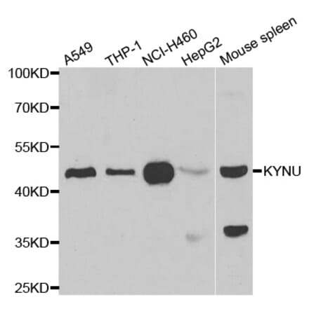 Anti-KYNU Antibody from Bioworld Technology (BS8320) - Antibodies.com