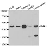 Anti-KYNU Antibody from Bioworld Technology (BS8320) - Antibodies.com