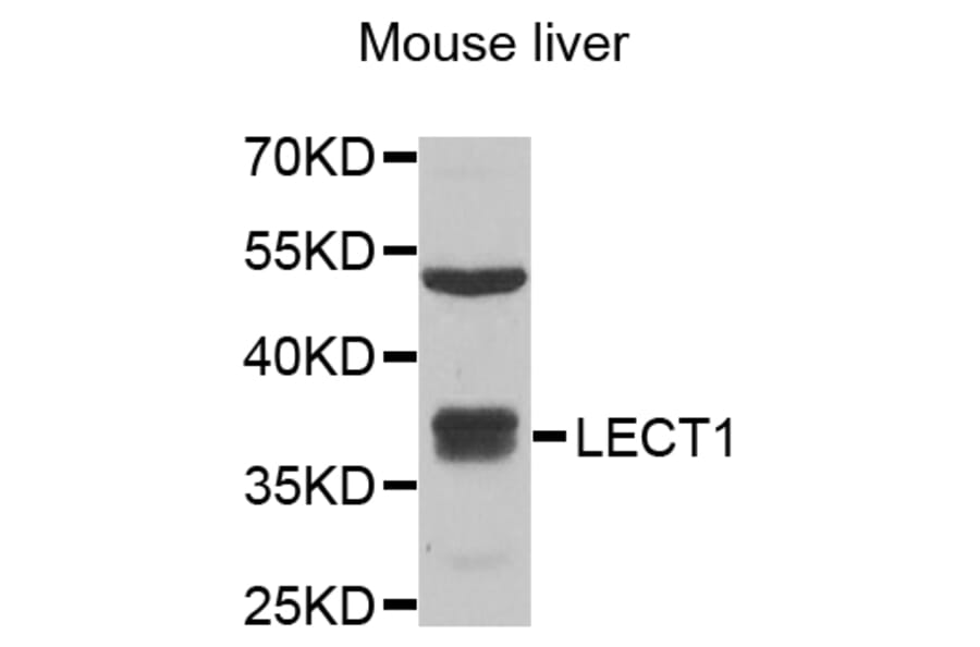 Anti-LECT1 Antibody from Bioworld Technology (BS8321) - Antibodies.com