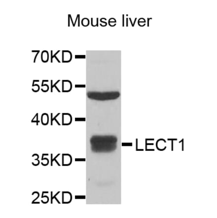 Anti-LECT1 Antibody from Bioworld Technology (BS8321) - Antibodies.com