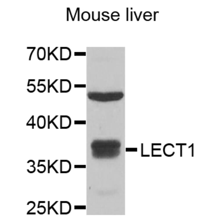 Anti-LECT1 Antibody from Bioworld Technology (BS8321) - Antibodies.com