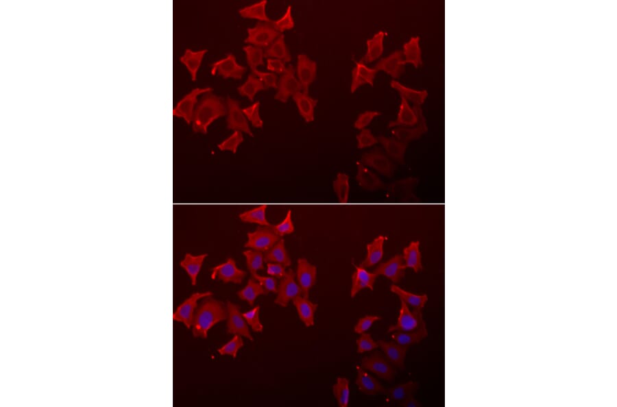 Anti-LECT1 Antibody from Bioworld Technology (BS8321) - Antibodies.com