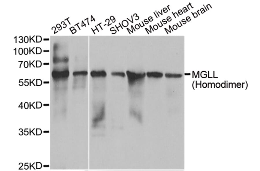 Anti-MGLL Antibody from Bioworld Technology (BS8329) - Antibodies.com