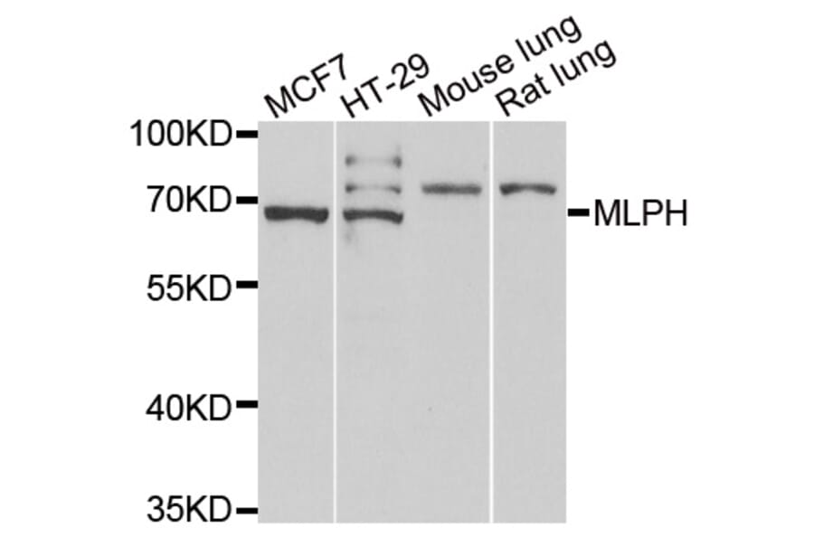 Anti-MLPH Antibody from Bioworld Technology (BS8330) - Antibodies.com