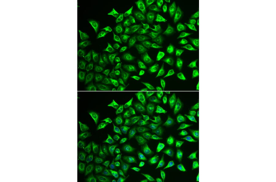 Anti-MMRN1 Antibody from Bioworld Technology (BS8331) - Antibodies.com