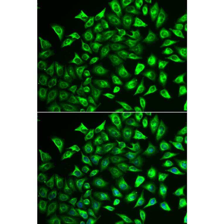 Anti-MMRN1 Antibody from Bioworld Technology (BS8331) - Antibodies.com