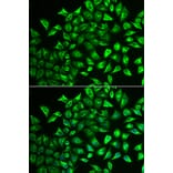 Anti-MMRN1 Antibody from Bioworld Technology (BS8331) - Antibodies.com