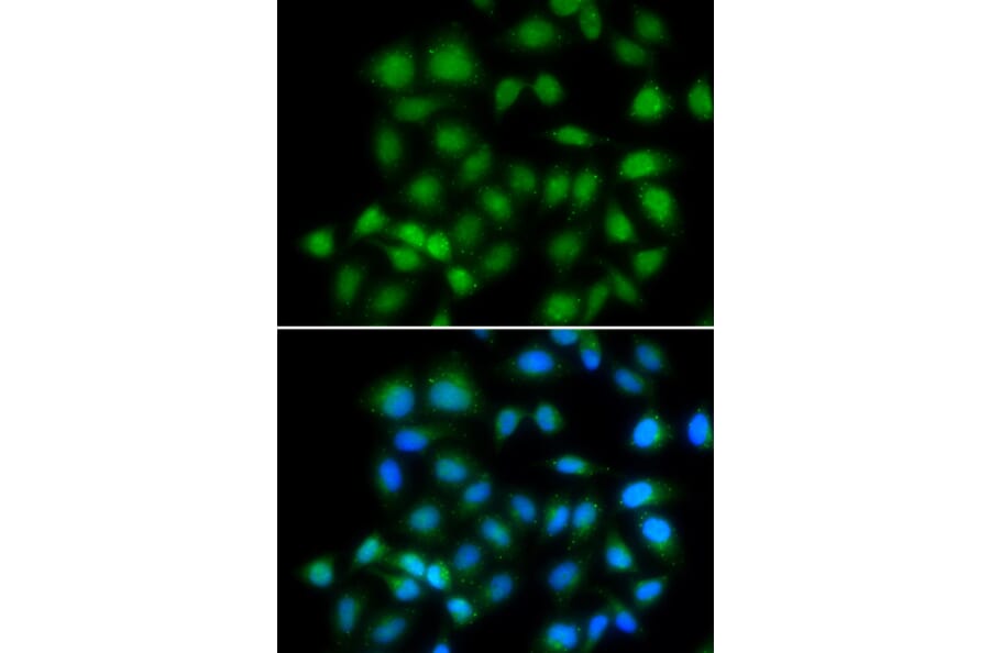 Anti-MXI1 Antibody from Bioworld Technology (BS8334) - Antibodies.com