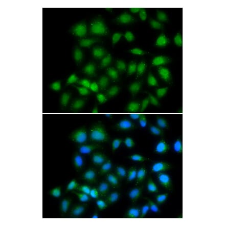Anti-MXI1 Antibody from Bioworld Technology (BS8334) - Antibodies.com