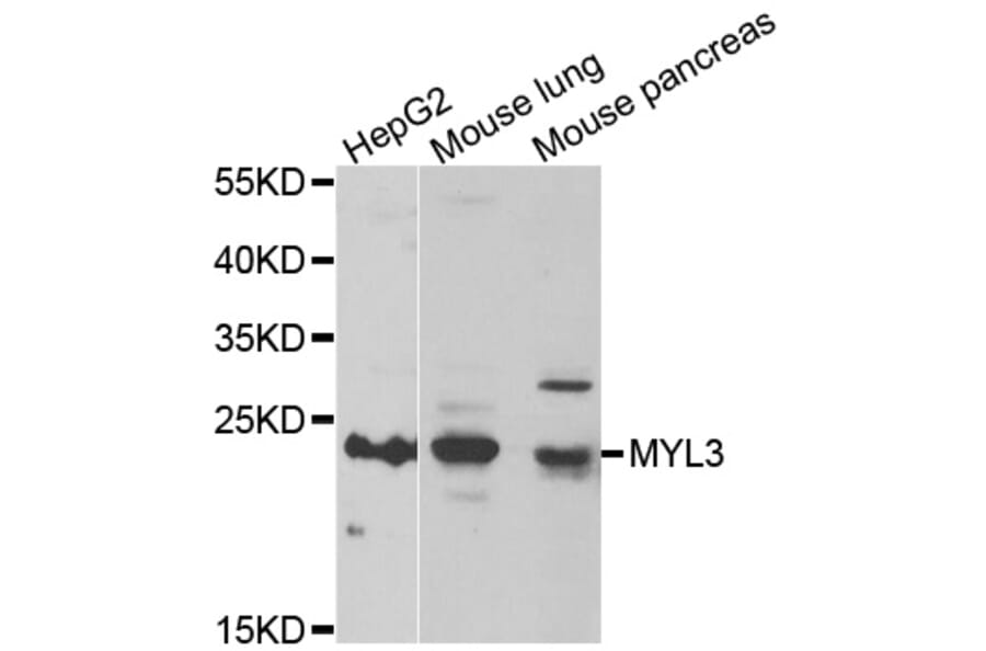 Anti-MYL3 Antibody from Bioworld Technology (BS8335) - Antibodies.com
