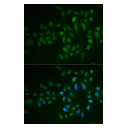 Anti-MYLK3 Antibody from Bioworld Technology (BS8336) - Antibodies.com