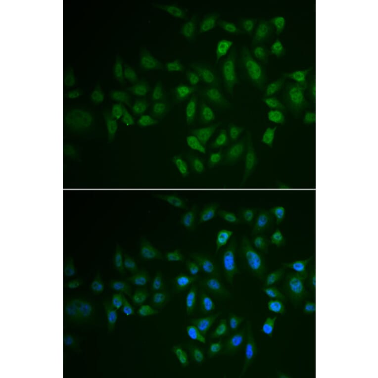 Anti-MYLK3 Antibody from Bioworld Technology (BS8336) - Antibodies.com