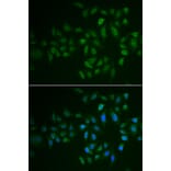 Anti-MYLK3 Antibody from Bioworld Technology (BS8336) - Antibodies.com