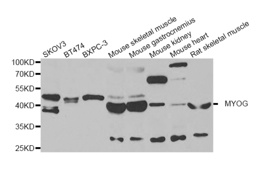 Anti-MYOG Antibody from Bioworld Technology (BS8337) - Antibodies.com