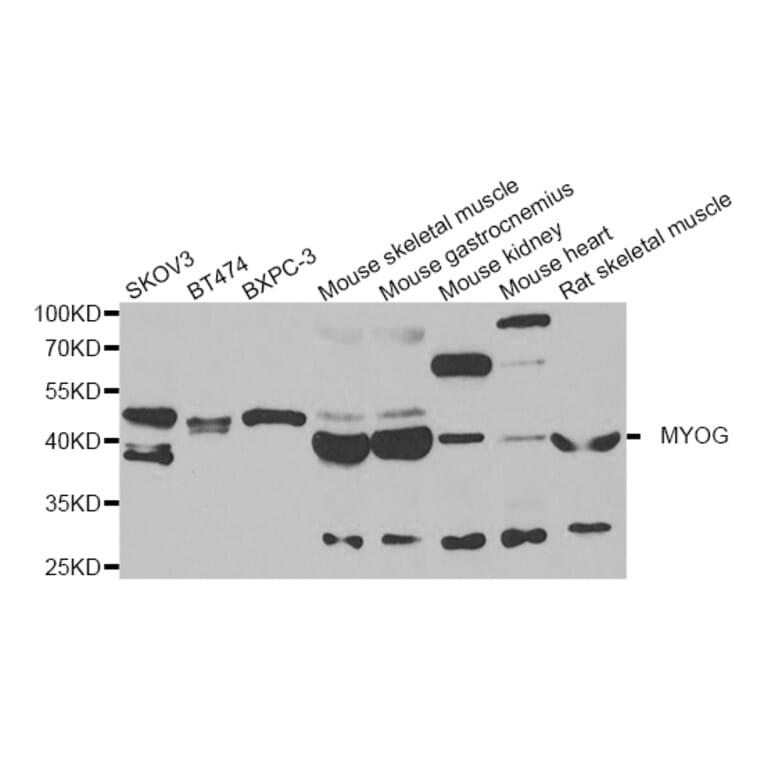 Anti-MYOG Antibody from Bioworld Technology (BS8337) - Antibodies.com
