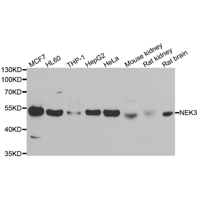 Anti-NEK3 Antibody from Bioworld Technology (BS8338) - Antibodies.com