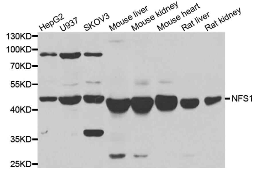 Anti-NFS1 Antibody from Bioworld Technology (BS8339) - Antibodies.com