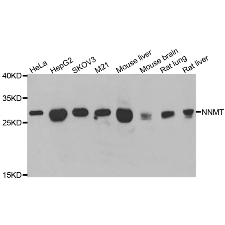 Anti-NNMT Antibody from Bioworld Technology (BS8344) - Antibodies.com