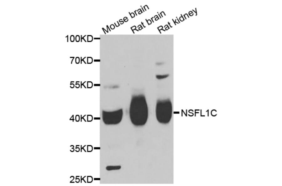 Anti-NSFL1C Antibody from Bioworld Technology (BS8346) - Antibodies.com