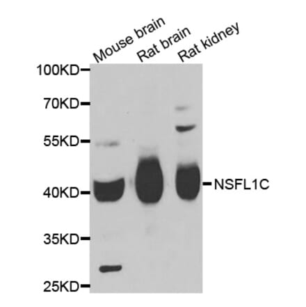 Anti-NSFL1C Antibody from Bioworld Technology (BS8346) - Antibodies.com