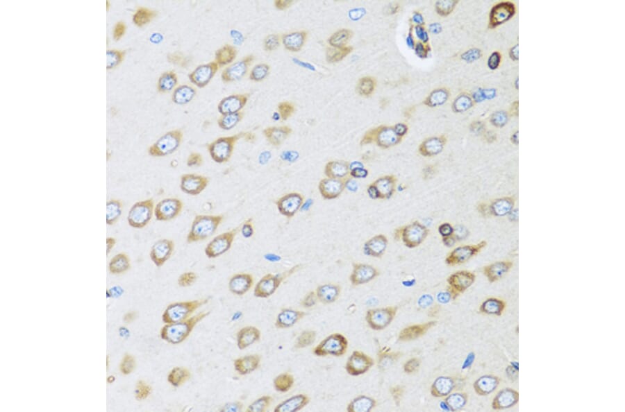 Anti-OGN Antibody from Bioworld Technology (BS8348) - Antibodies.com
