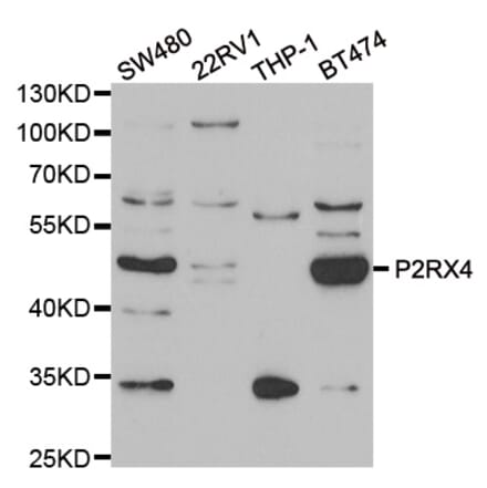 Anti-P2RX4 Antibody from Bioworld Technology (BS8351) - Antibodies.com
