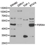 Anti-P2RX4 Antibody from Bioworld Technology (BS8351) - Antibodies.com